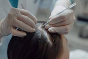 تخت کاشت مو برای کلینیک زیبایی و بیمارستان