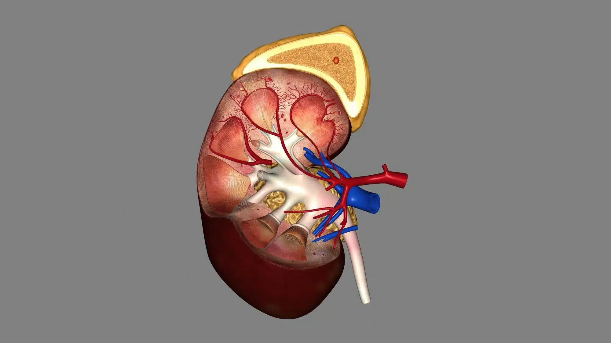 نارسایی کلیوی حاد